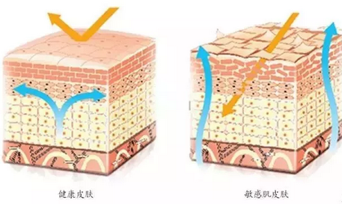 敏感肌膚與健康肌膚的對比，導(dǎo)致肌膚敏感的原因有哪些