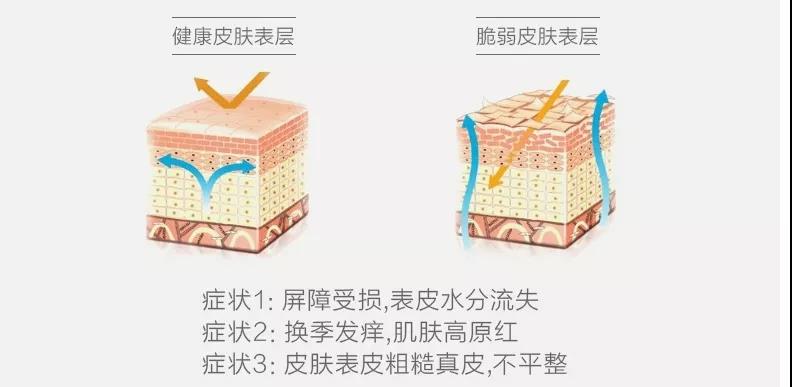 敏感肌表皮層