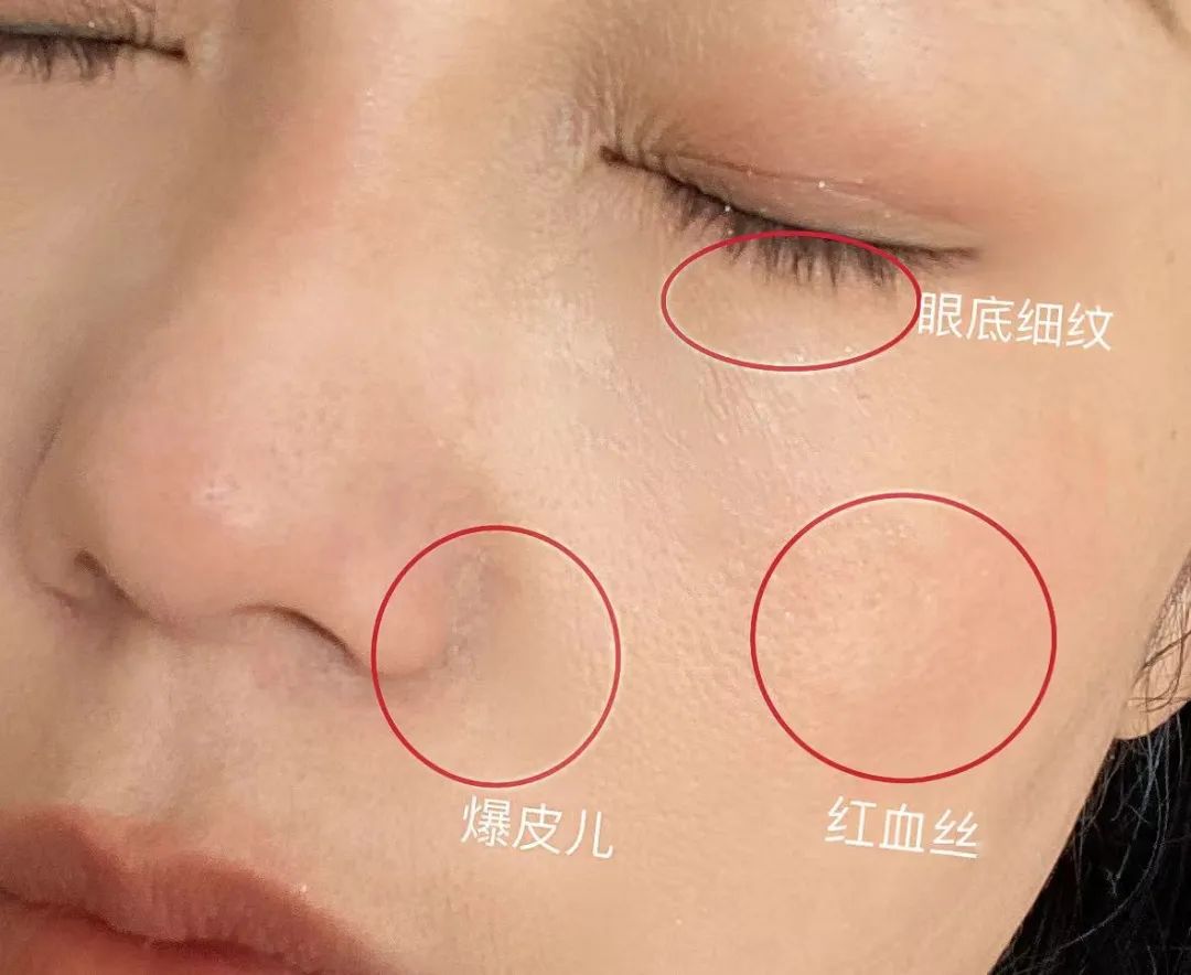 如何判斷自己是不是干敏肌膚？干敏肌有哪些特征？