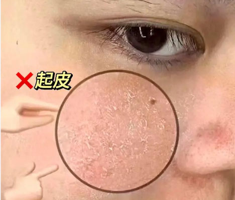 化完妝后臉上起皮怎么補(bǔ)救？