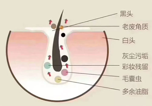 為什么要定期做皮膚深層清潔？